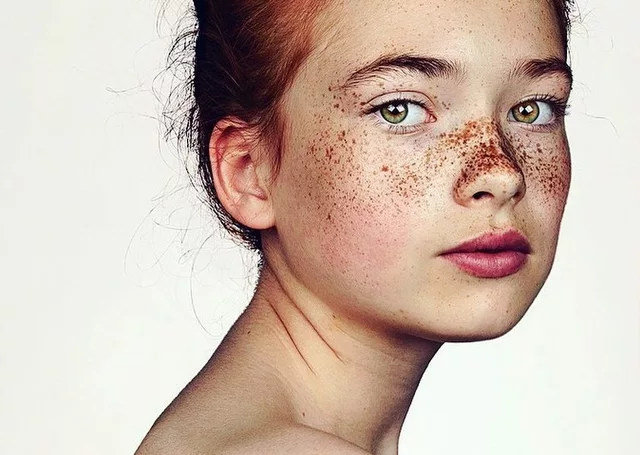 How to embrace and celebrate your freckles as a part of your unique beauty